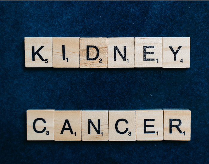 The Influence of Lifestyle Modification on the Prevention of Urological Cancer